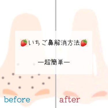 こんにちは🥱🥱

ぽかですっ⸜( ◜࿁◝ )⸝︎

今回は…【いちご鼻を消す方法🍓】を紹介していきます！

それではLet's Go!!!!

────────────────────────
ーやった