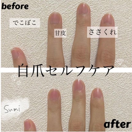 爪ミガキセット/デュカート/ネイル用品を使ったクチコミ(1枚目)