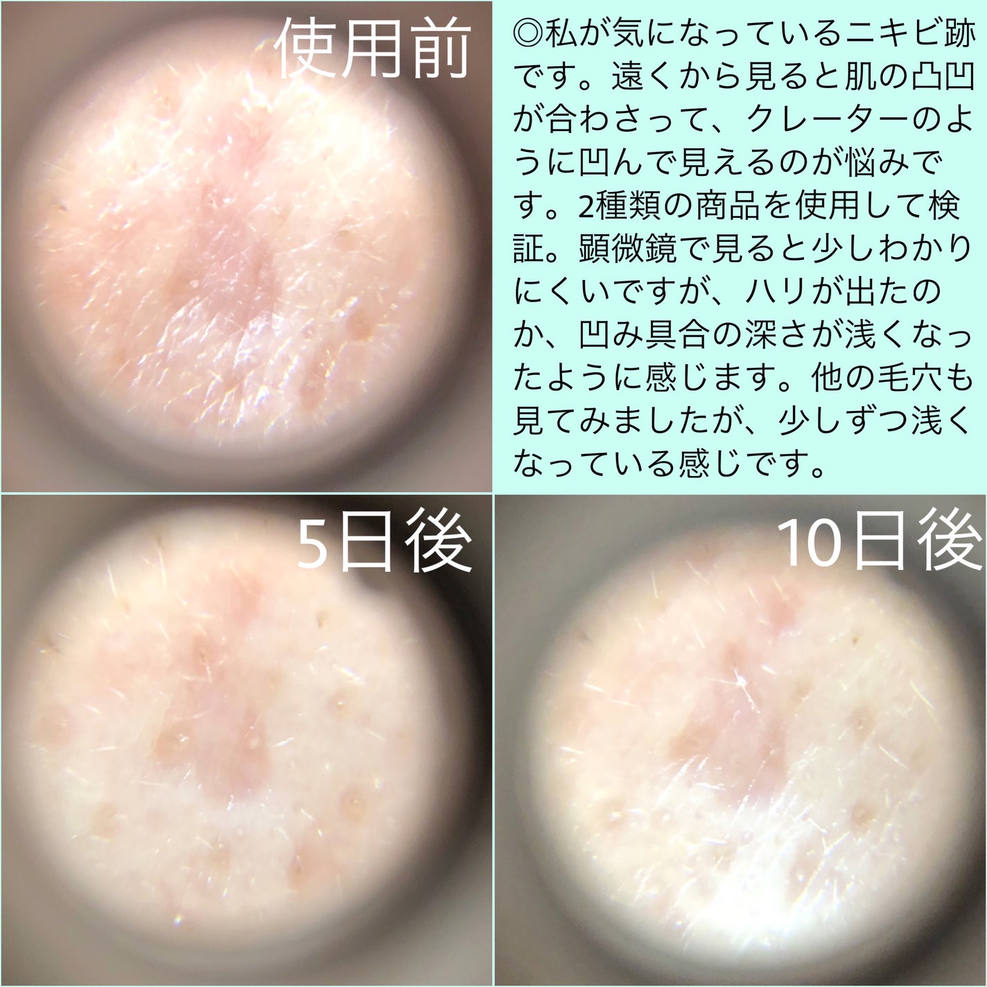 プロCICAリードルショット100/VT/ブースター・導入液を使ったクチコミ(5枚目)