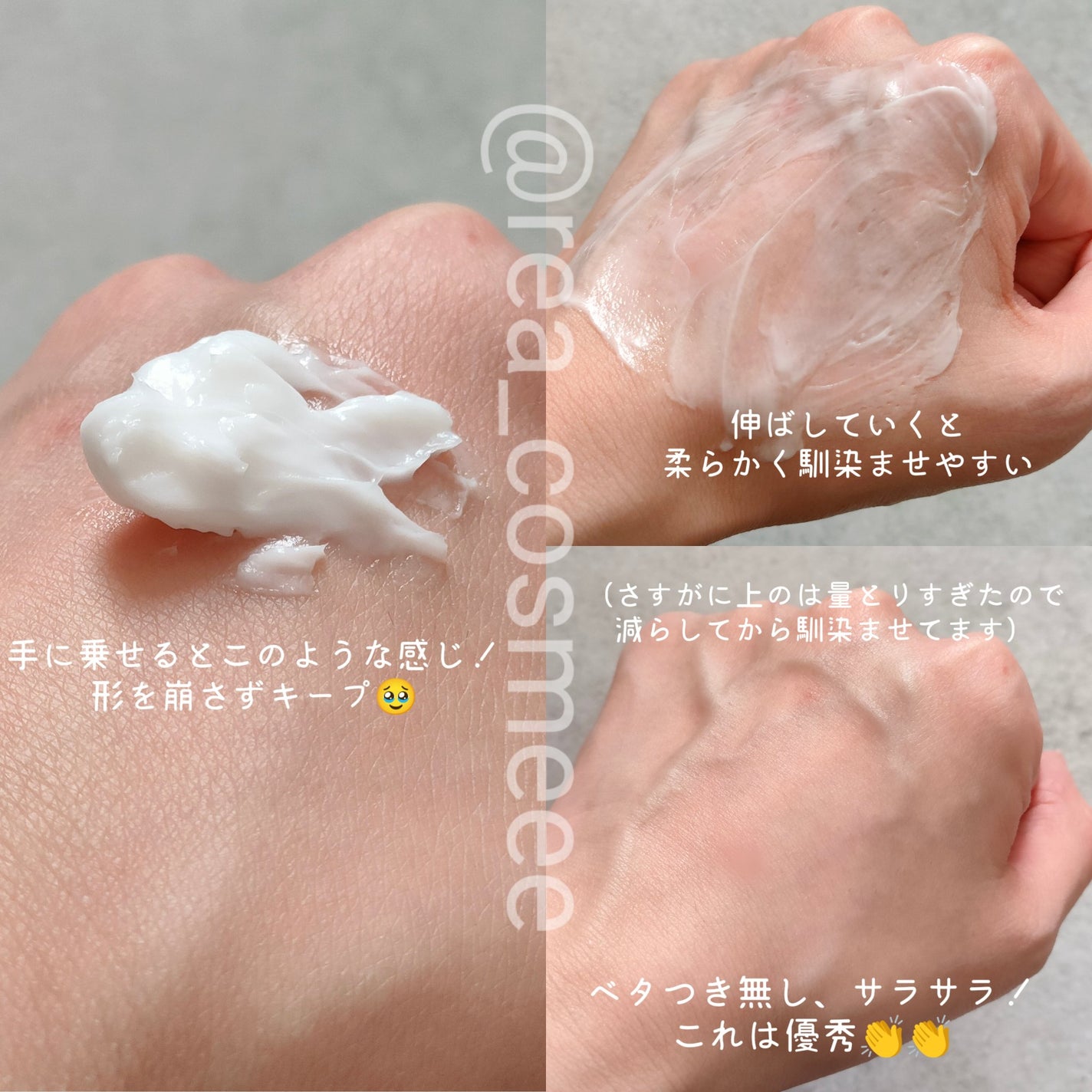 モイスチャライジング クリーム/セタフィル/ボディクリームを使ったクチコミ(5枚目)