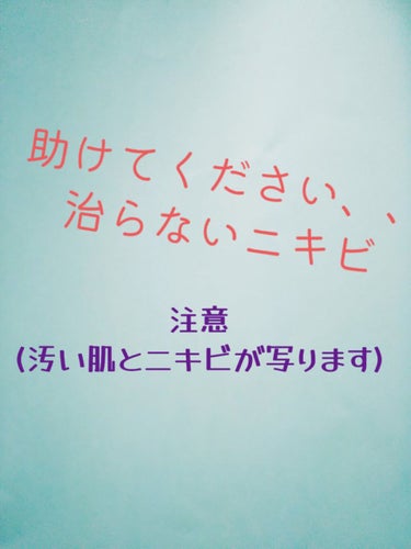 オロナイン オロナインＨ軟膏 (医薬品)のクチコミ「上の写真を見てくれた人はわかると思いますが、ぶつぶつの思春期ニキビに困っています、、。
オロナ.....」（1枚目）