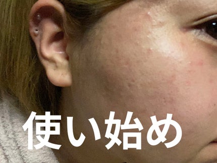 ぴよぴよ_フォロバ100%♡ on LIPS 「途中経過です..」(1枚目)