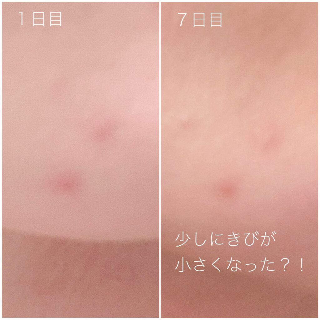 モアリッチパック/meeth/シートマスク・パックを使ったクチコミ(4枚目)