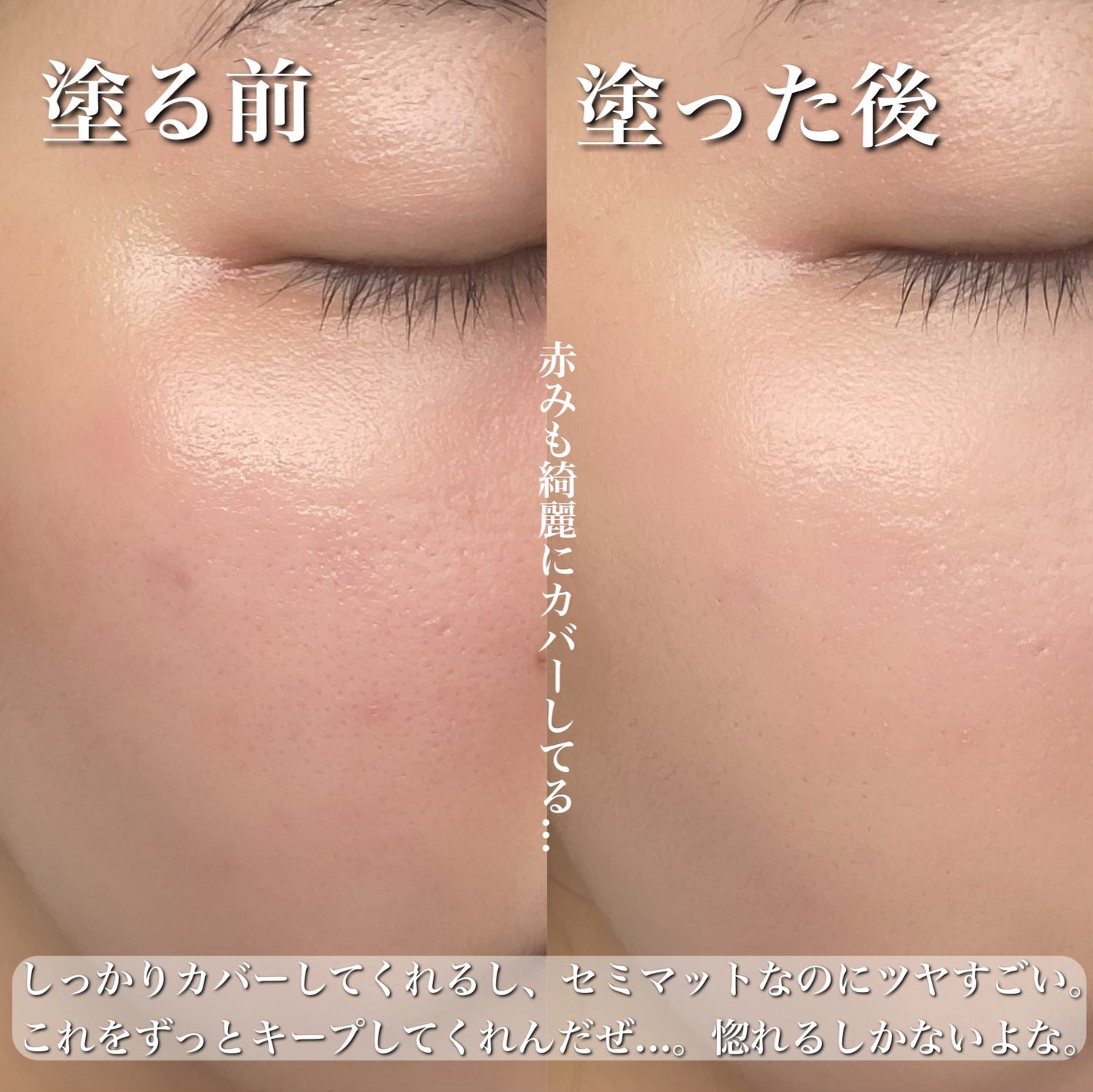 ピンクティーツリーカバークッション/APLIN/クッションファンデーションを使ったクチコミ(4枚目)