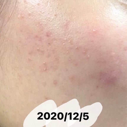 を使ったクチコミ(2枚目)