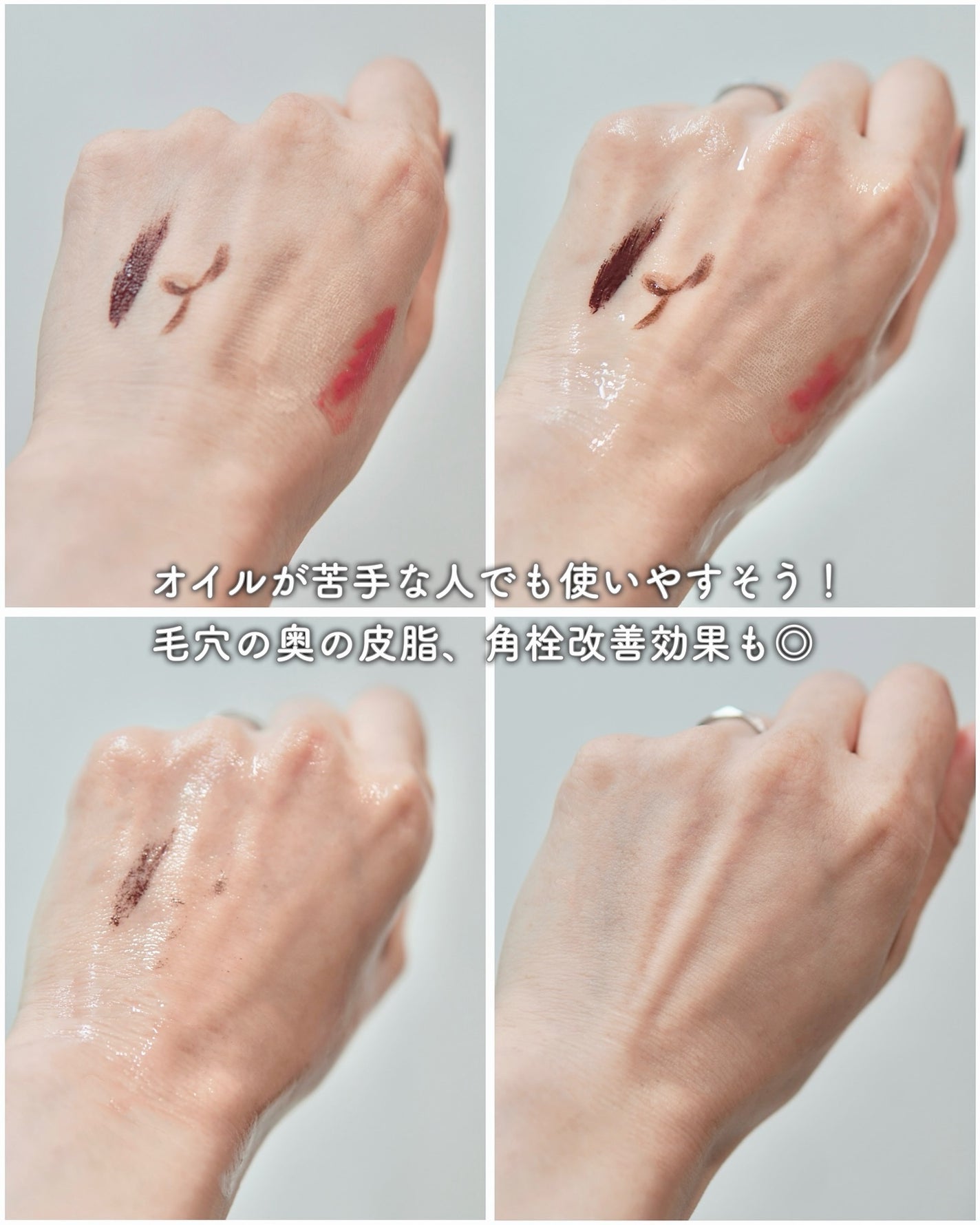 エクストリームエッセンストナーオリジナル/Real Barrier/化粧水を使ったクチコミ(7枚目)