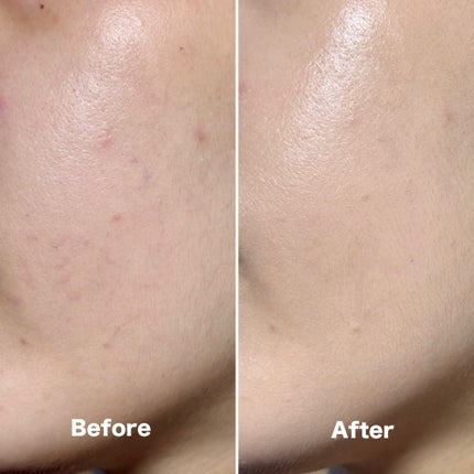 スキンバリアグロウカバークッション/Ongredients/クッションファンデーションを使ったクチコミ(3枚目)