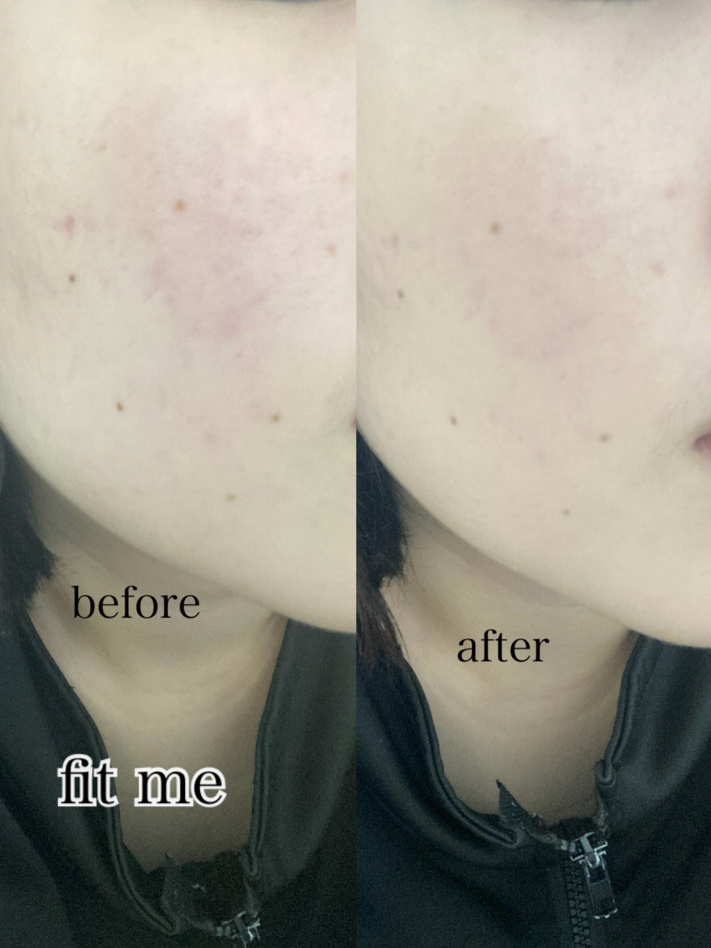 フィットミー リキッドファンデーション R/MAYBELLINE NEW YORK/リキッドファンデーションを使ったクチコミ(6枚目)