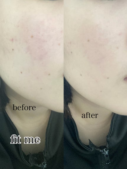 フィットミー リキッドファンデーション R/MAYBELLINE NEW YORK/リキッドファンデーションを使ったクチコミ(6枚目)