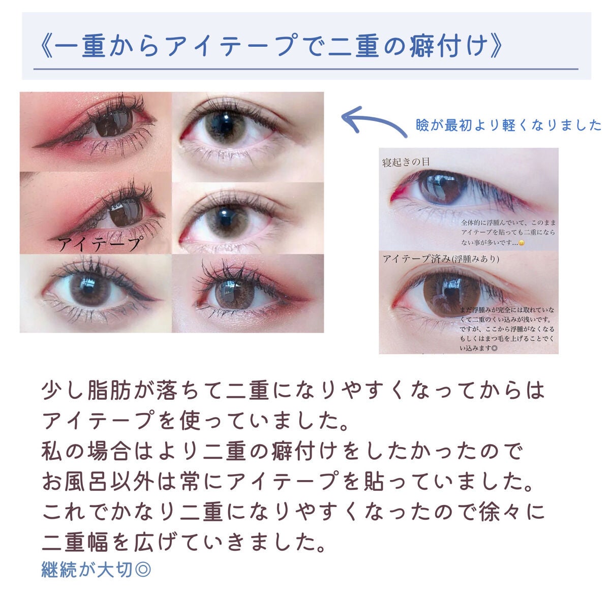 のびーるアイテープ(絆創膏タイプ、レギュラー)/DAISO/二重まぶた用アイテムを使ったクチコミ(4枚目)