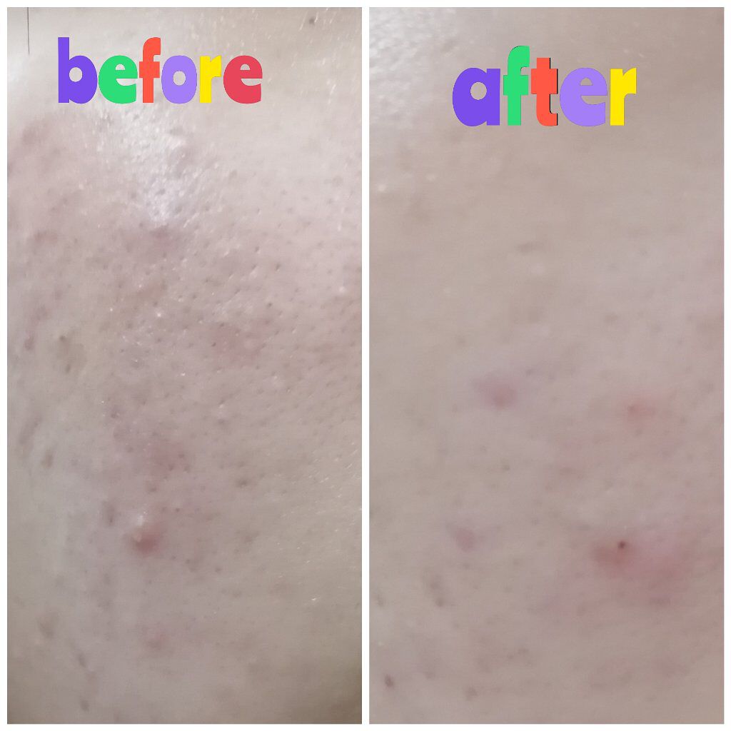 マイルド＆モイスチャーアロエジェル/ネイチャーリパブリック/ボディローションを使ったクチコミ（2枚目）