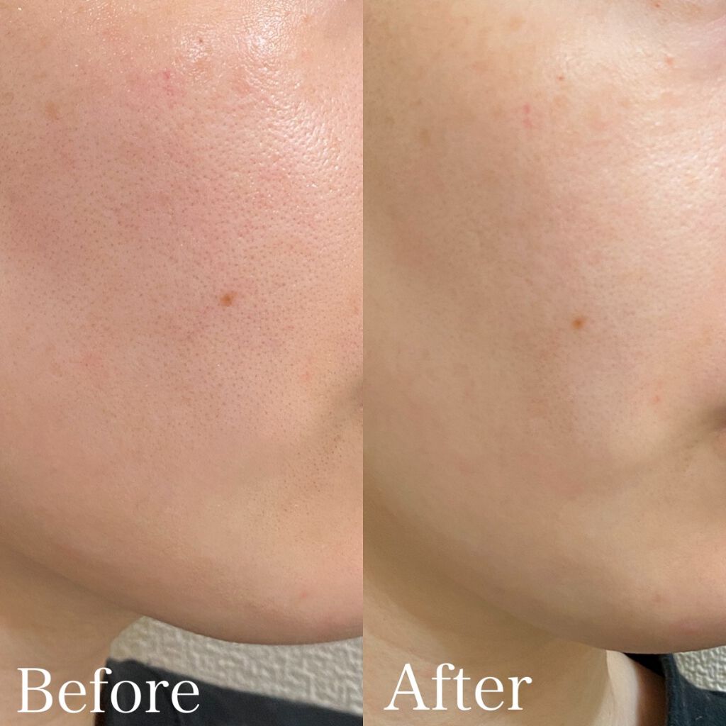 パーフェクト ポア プログラム/LAVIEN/その他スキンケアを使ったクチコミ（3枚目）