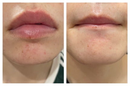 ドクダミ 77 スージングトナー/Anua/化粧水を使ったクチコミ(4枚目)