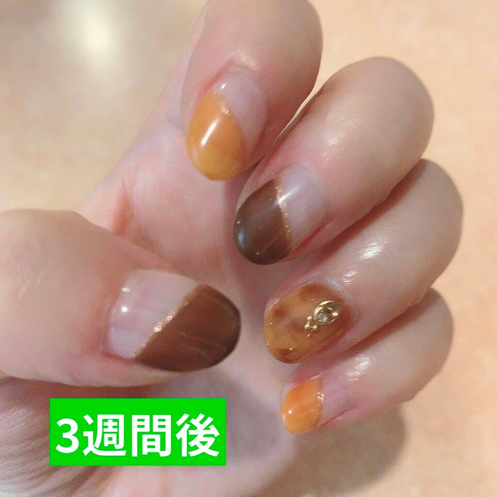 さ on LIPS 「深爪・チビ爪矯正日記🤞私自身ずっと爪を噛むクセがあって大学入っ..」(2枚目)