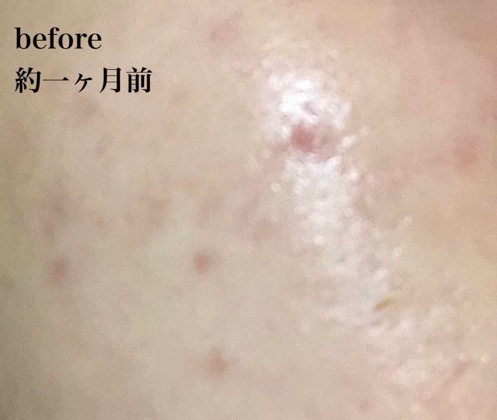 ドクタージャルト シカペア クリーム （第2世代）/Dr.Jart＋/フェイスクリームを使ったクチコミ（2枚目）