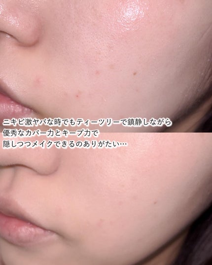 ピンクティーツリーカバークッション/APLIN/クッションファンデーションを使ったクチコミ(4枚目)