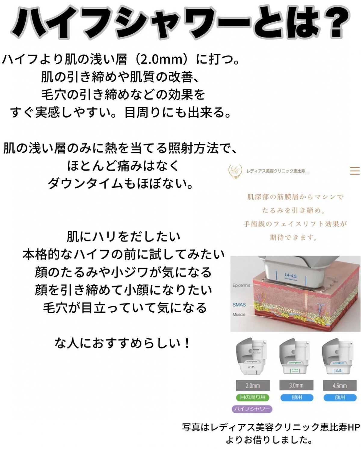 りっちゃん on LIPS 「ハイフシャワー受けてきました/実はハイフはやった事がなくて…..」(2枚目)