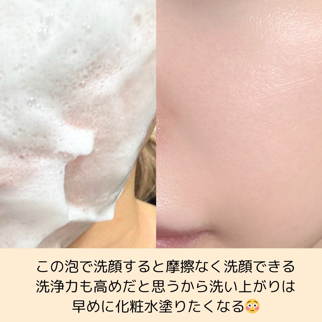 毛穴撫子 愛媛みかんの重曹泡洗顔/毛穴撫子/洗顔フォームを使ったクチコミ(2枚目)