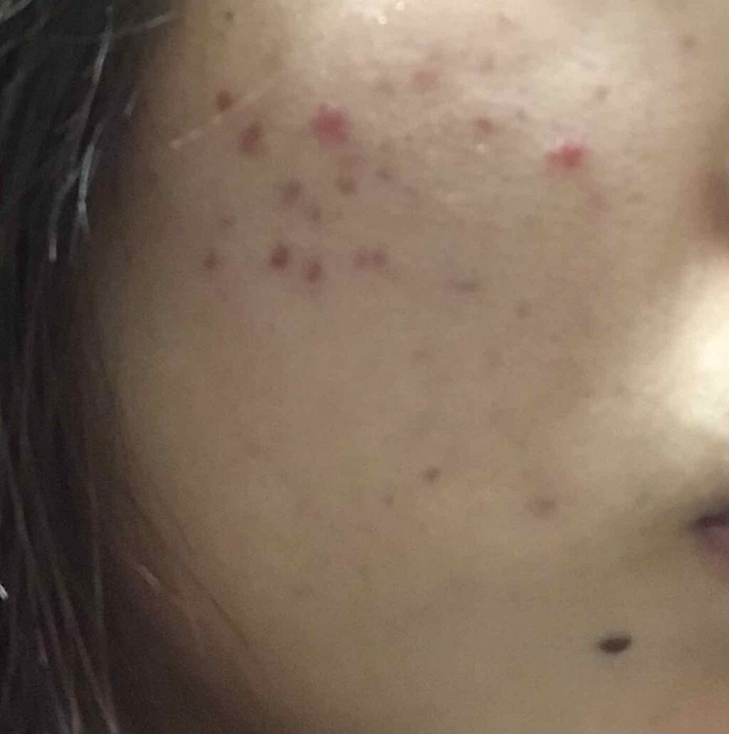 ミノン アミノモイスト モイストチャージ ミルク/ミノン/乳液を使ったクチコミ（2枚目）