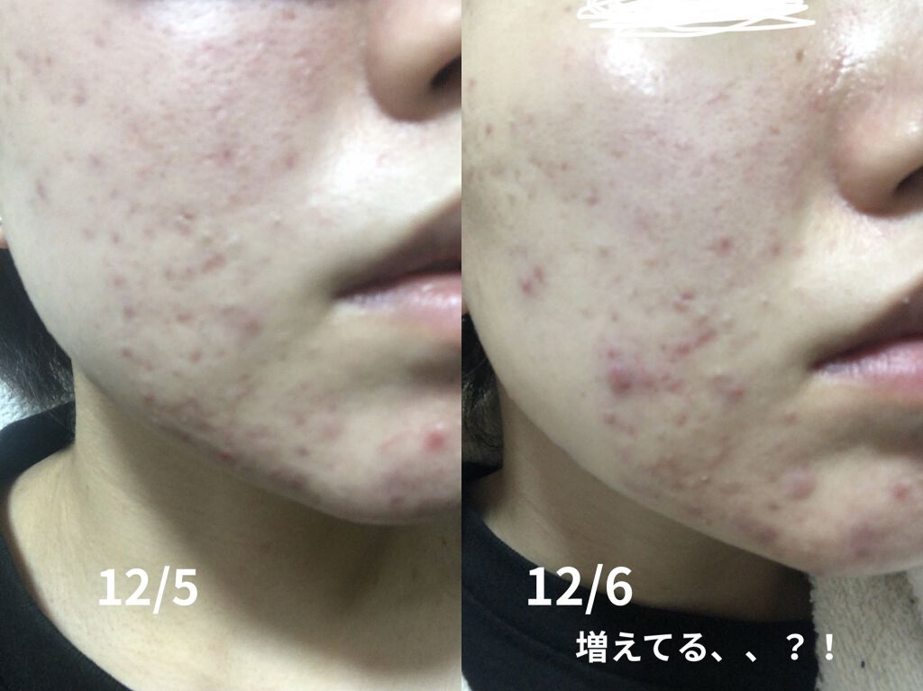 抱擁の満月/ラッシュ/フェイスバームを使ったクチコミ（2枚目）