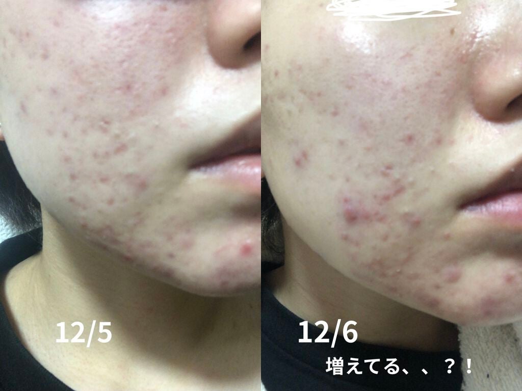 抱擁の満月/ラッシュ/フェイスバームを使ったクチコミ(2枚目)