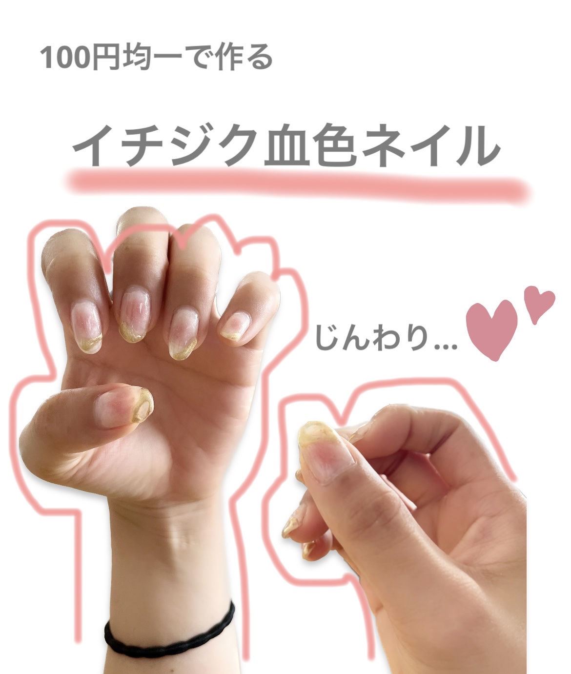 ジェルネイルDA/IDATE/ジェルネイルを使ったクチコミ（1枚目）