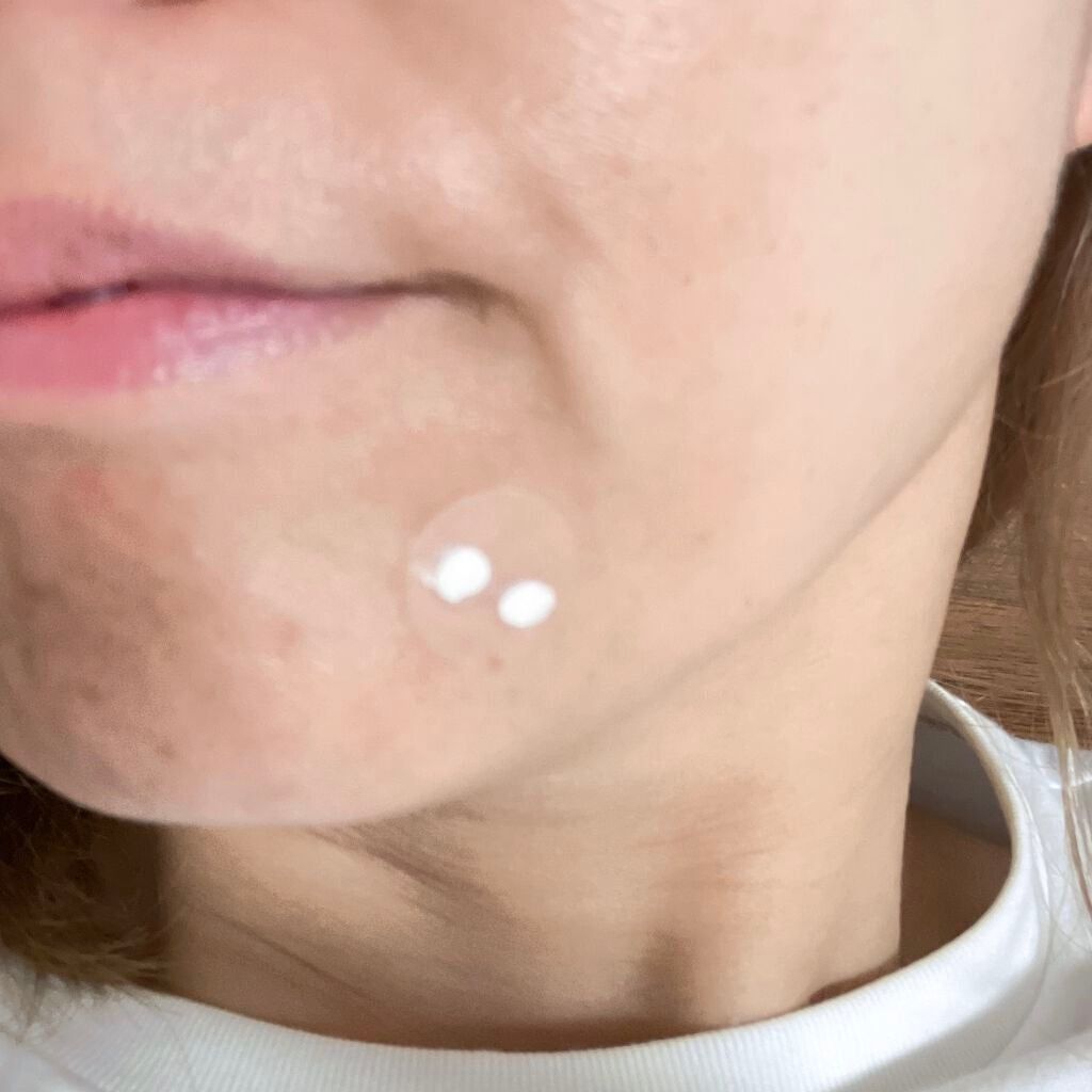 薬用ニキビケア スポッツクリーム/アクネスラボ/フェイスクリームを使ったクチコミ(7枚目)