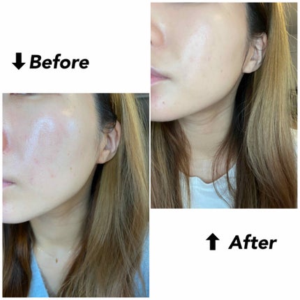 フィットミー リキッドファンデーション R/MAYBELLINE NEW YORK/リキッドファンデーションを使ったクチコミ(2枚目)