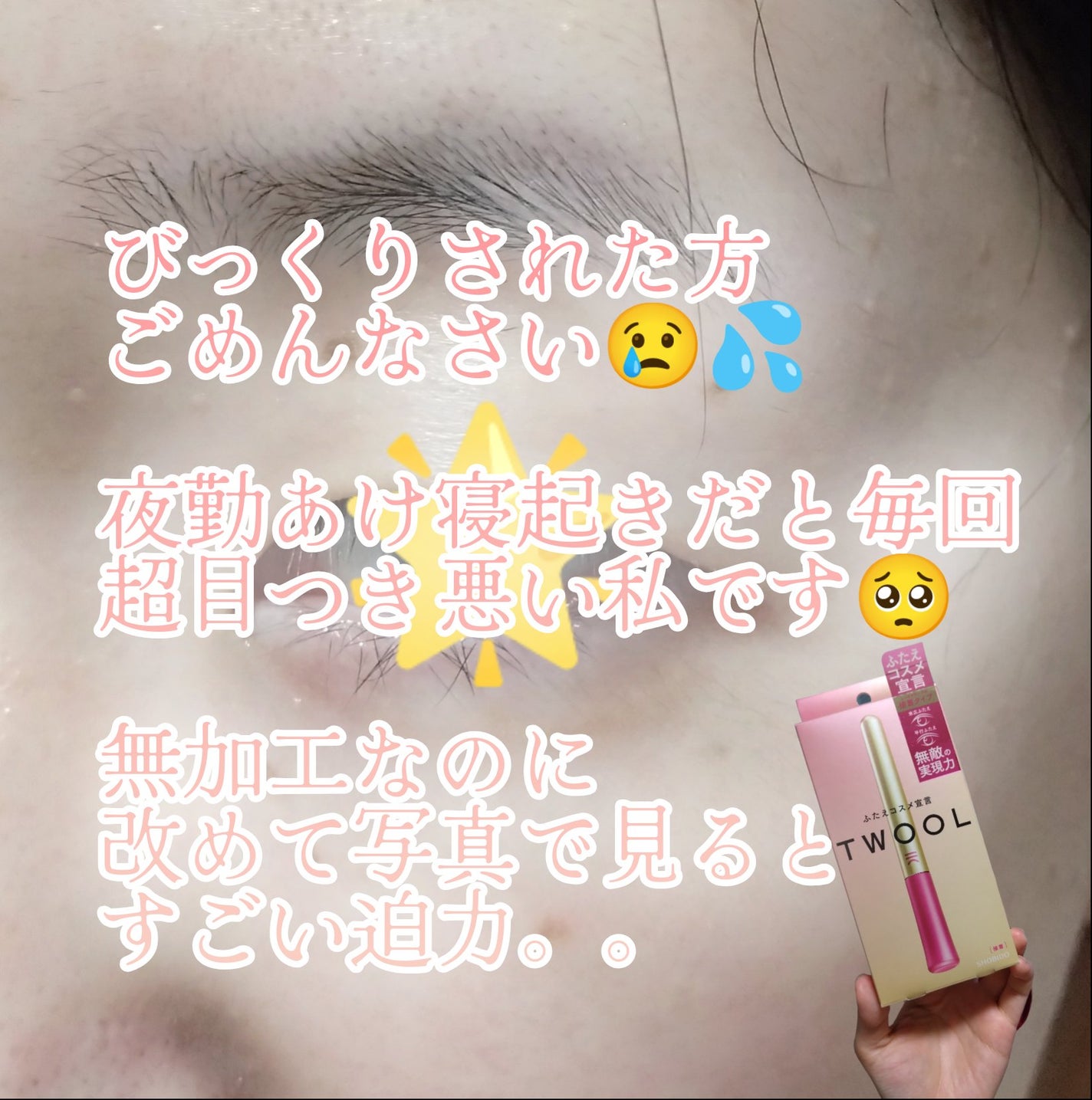 ã¢ã€ããŒã¯ ã¯ãªã¢ãžã§ã«/ã¢ã€ããŒã¯/äºéãŸã¶ãçšã¢ã€ãã ã䜿ã£ãã¯ãã³ãïŒ2æç®ïŒ