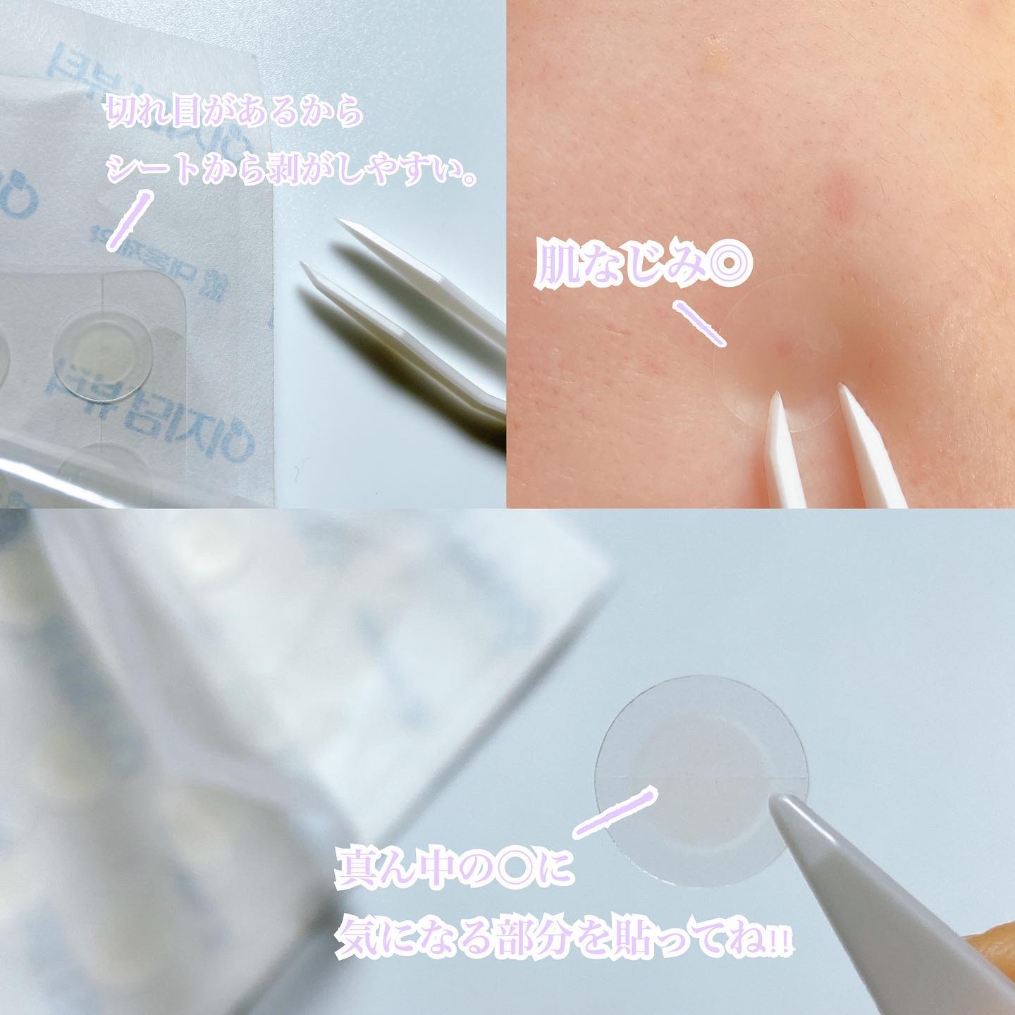 ビューティー スポットパッチ/イージーダムビューティー/にきびパッチを使ったクチコミ（3枚目）