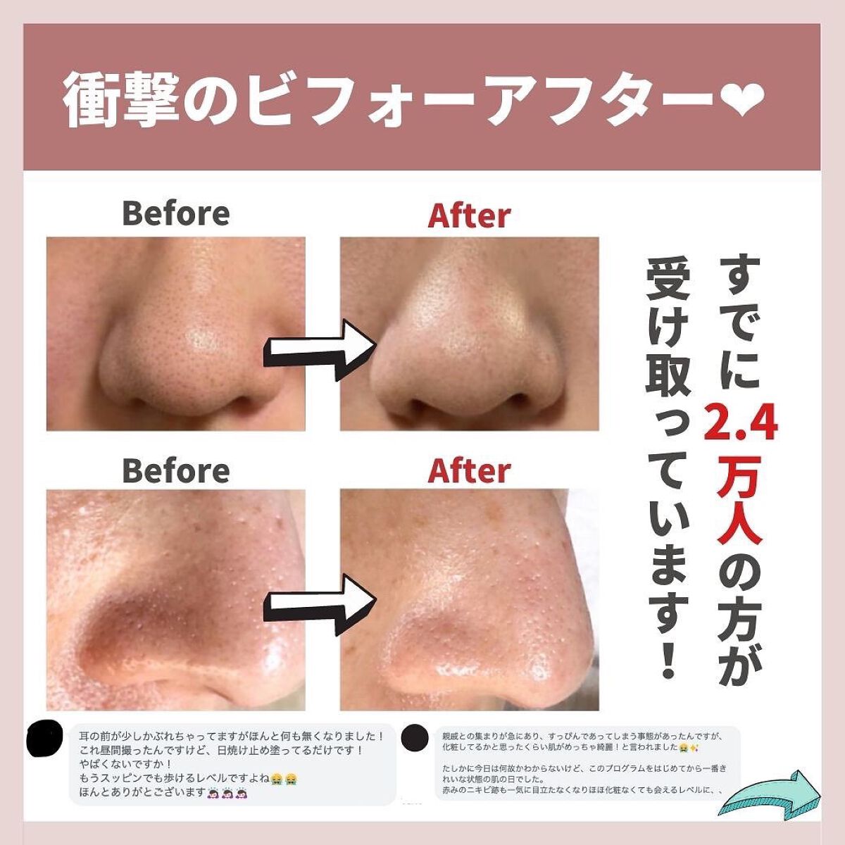 あなたの肌に合ったスキンケア💐コーくん先生 on LIPS 「【鼻の黒ずみを確実に消す方法】.
.
あなたの鼻の黒ずみが治ら..」(8枚目)