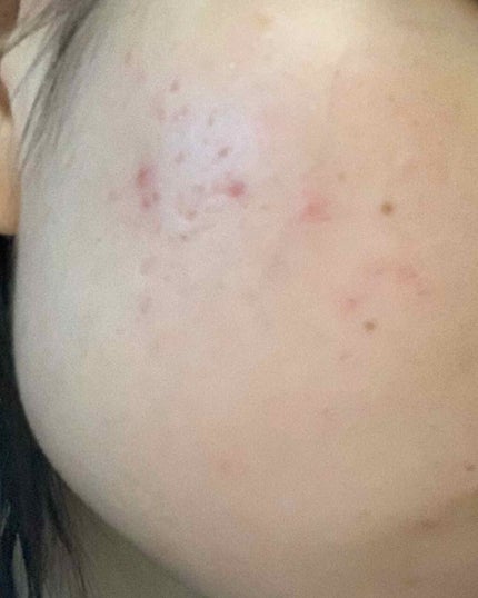 を使ったクチコミ(2枚目)