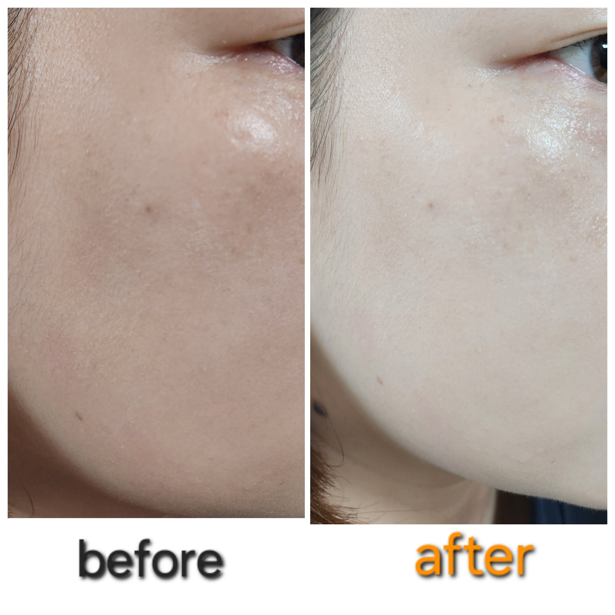 アイレノールすっぴんクリーム/IRENOL/クリームコンシーラーを使ったクチコミ（3枚目）