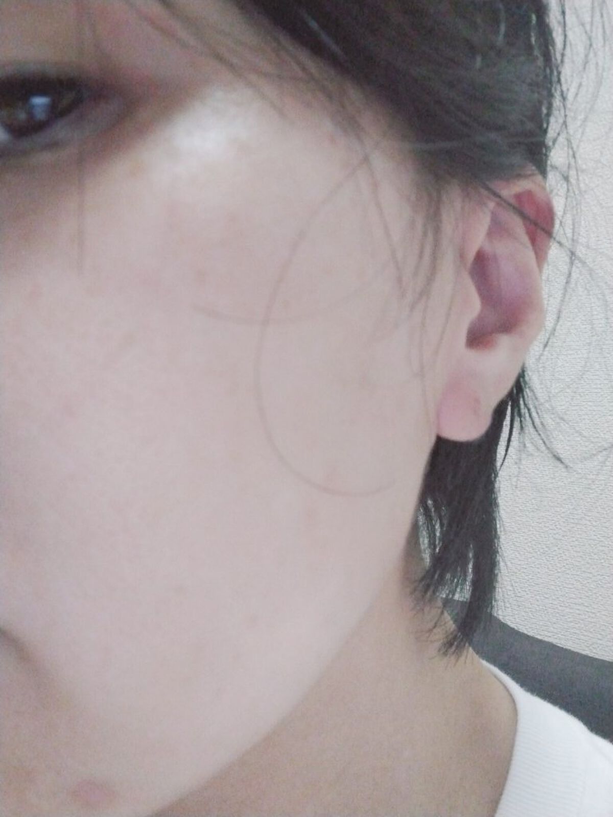 SUIKO HC ビタミン5エッセンスマスク/SUIKO HATSUCURE/シートマスク・パックを使ったクチコミ（2枚目）