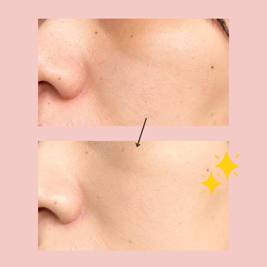 密着カバーファンデーション/GIVERNY/リキッドファンデーションを使ったクチコミ(4枚目)