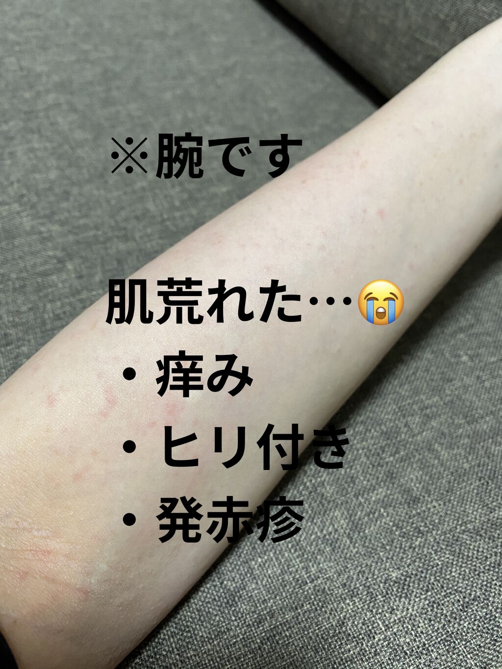 ボタニカルズ 除毛クリーム 敏感肌用/Veet/除毛クリームを使ったクチコミ（3枚目）