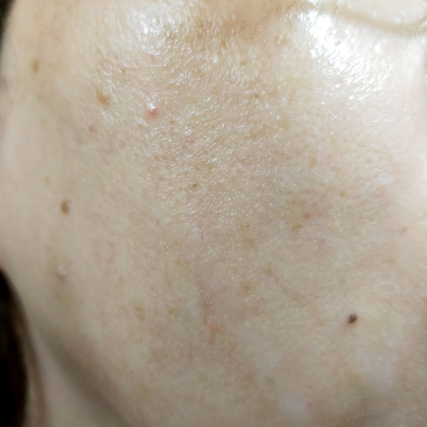 マデカ メラキャプチャー アンプルマスク/センテリアン24/シートマスク・パックを使ったクチコミ(6枚目)