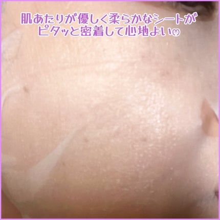 ルルルン ハイドラ EX マスク/ルルルン/シートマスク・パックを使ったクチコミ(4枚目)