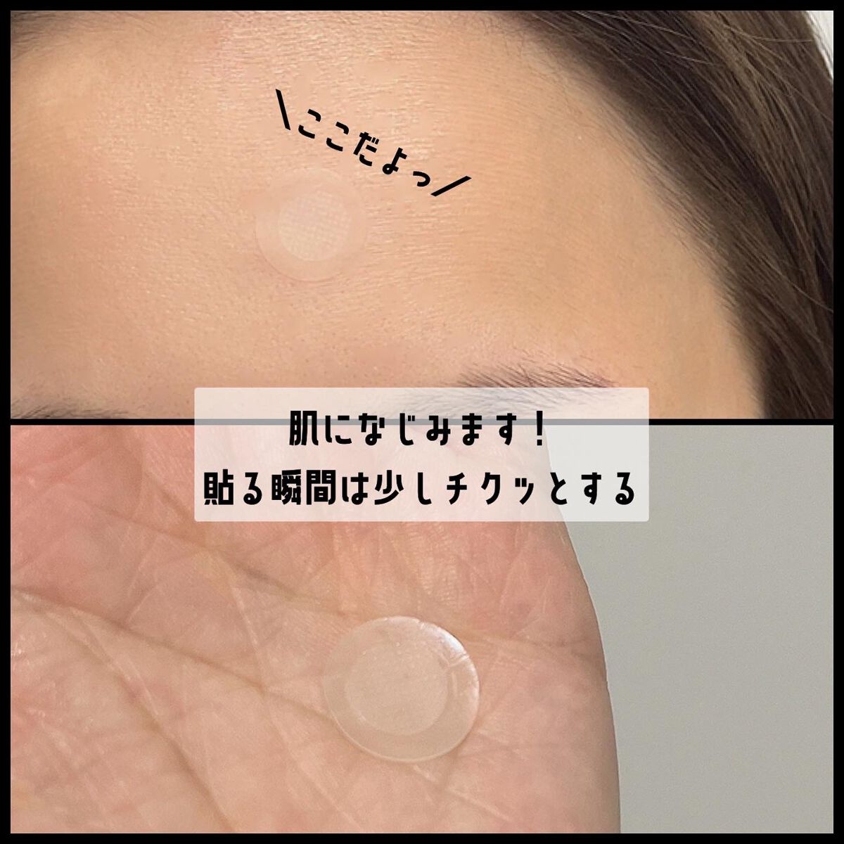 マジックティーツリーパッチ/ブラン/にきびパッチを使ったクチコミ(3枚目)