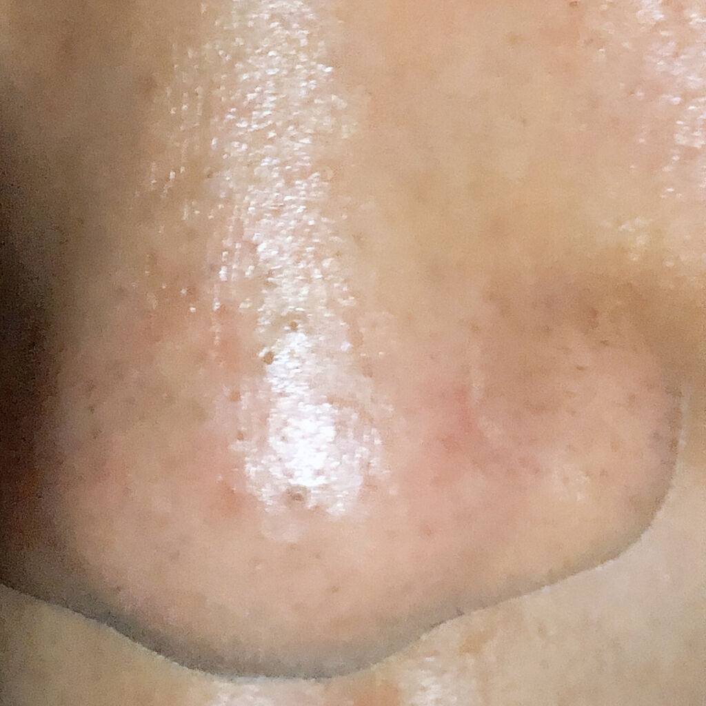 ウォーターピーリング/Panasonic/美顔器・マッサージを使ったクチコミ（3枚目）