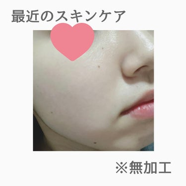 PURE ROSEHIP SEED OIL/Life-flo/フェイスオイルを使ったクチコミ（1枚目）