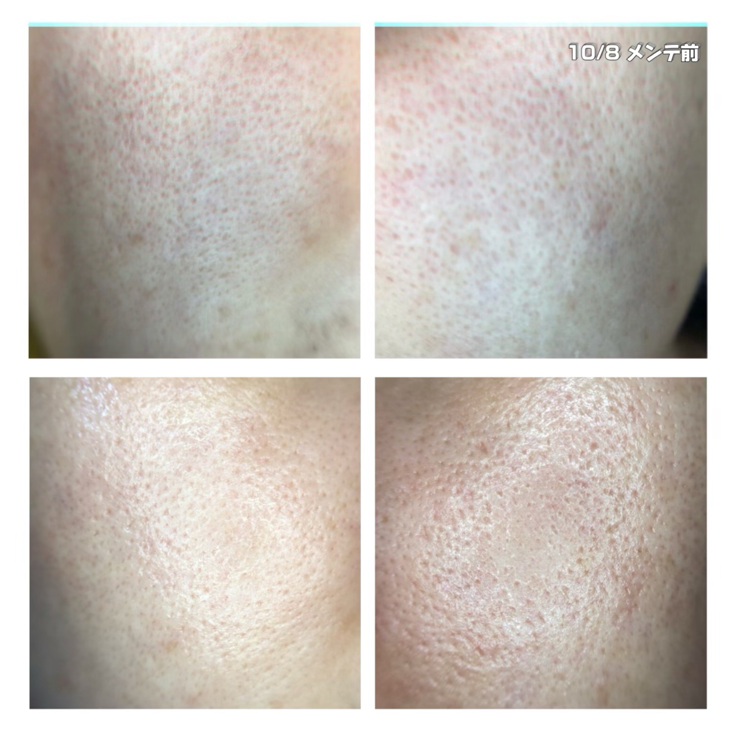 ヒートキャビシェイプ PRO/TBC/ボディケア美容家電を使ったクチコミ（3枚目）