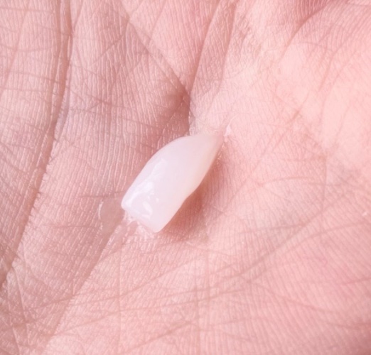 PERFECT HAIR FILL-UP/La'dor/洗い流すヘアトリートメントを使ったクチコミ（3枚目）