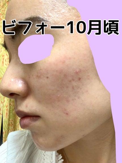 フレッシュリージュースドビタミンドロップ(35ml)/Klairs/美容液を使ったクチコミ(3枚目)