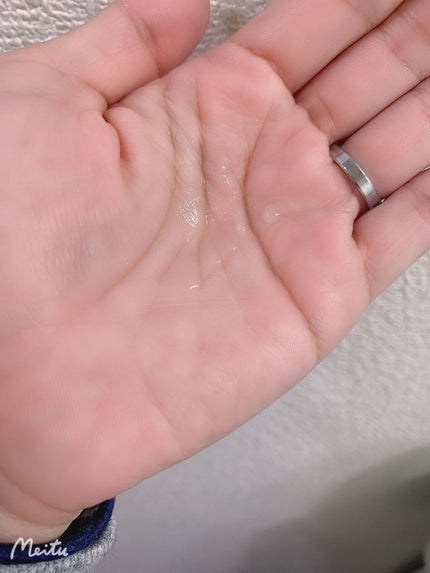 ð¶ããã¡ããð¶ on LIPS ãããªãŒãºãã©ã€çŸå®¹æ¶²BIOMULE(ããªãã¥ãŒã«)â¡Wã®ä¹³é
žè..ãïŒ4æç®ïŒ