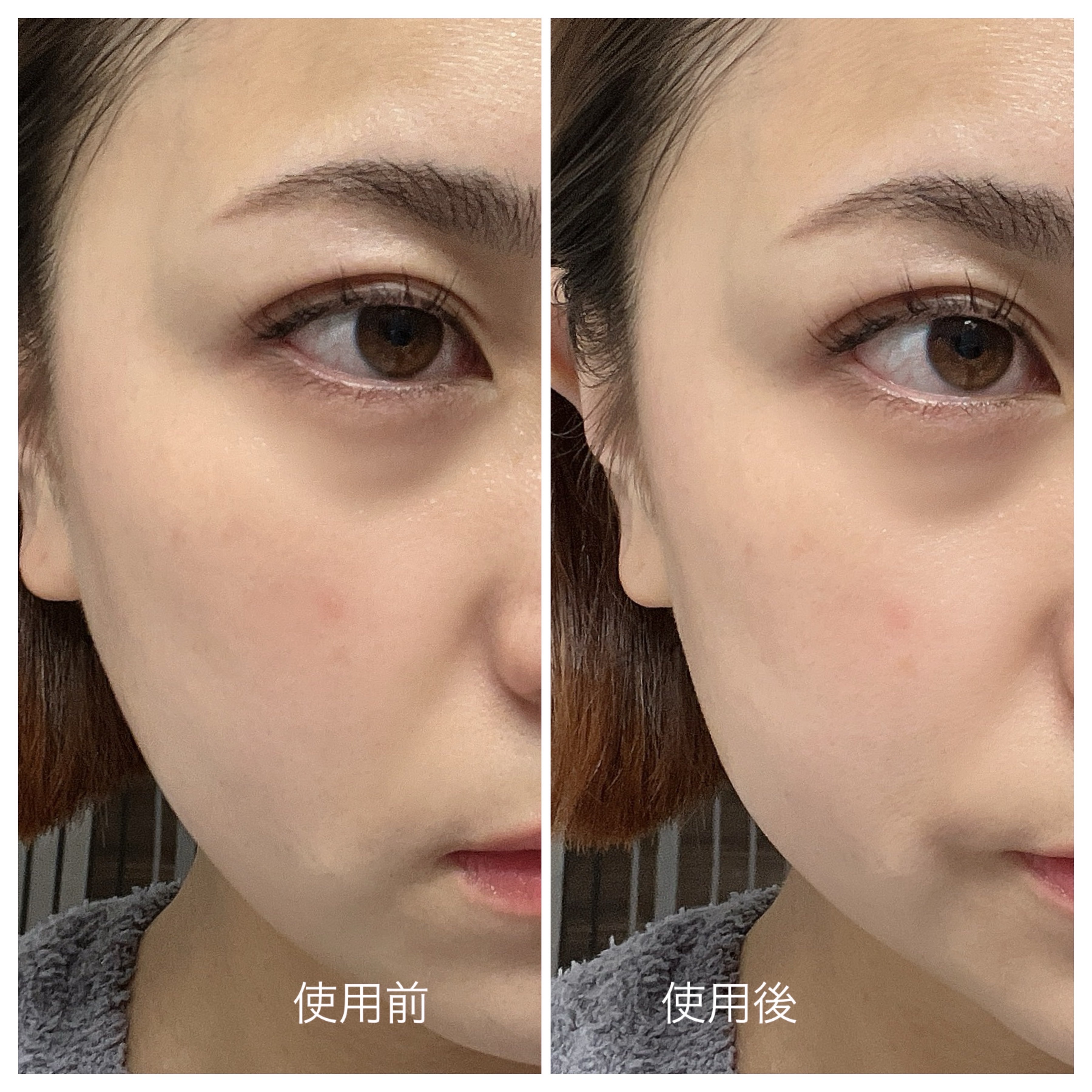 リンクルフィットテングルアイクリーム/MEDITHERAPY/アイケア・アイクリームを使ったクチコミ（3枚目）