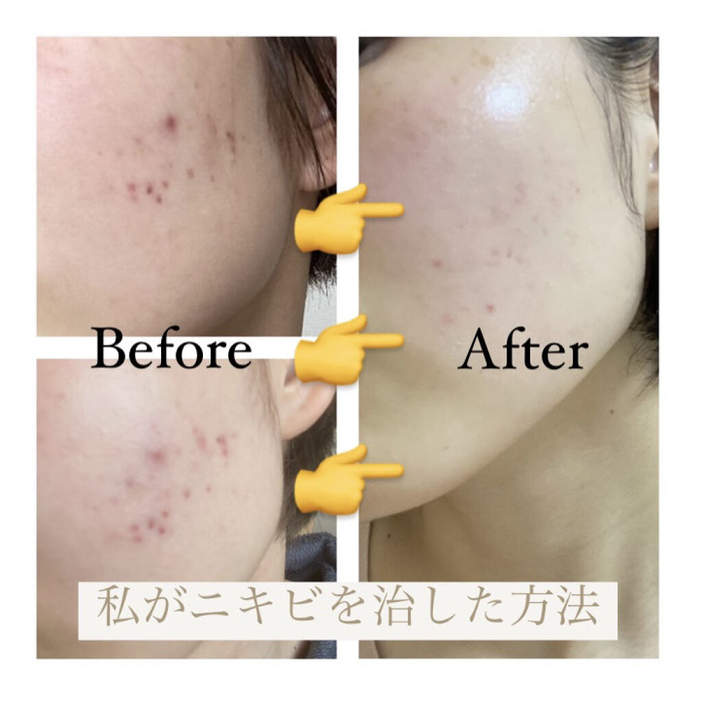 なめらか本舗 乳液 NA/なめらか本舗/乳液を使ったクチコミ（1枚目）