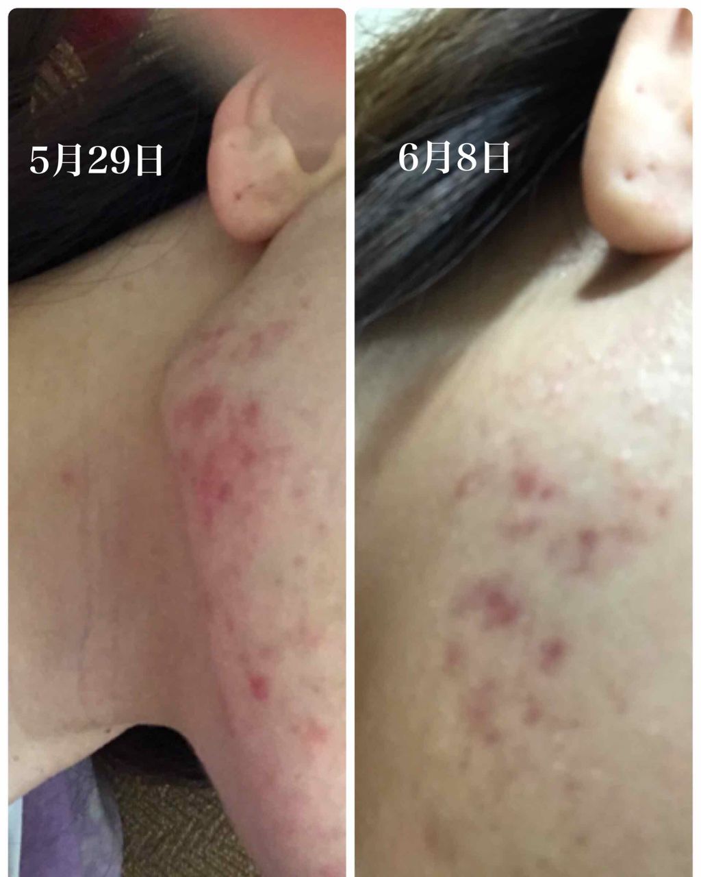 化粧水・敏感肌用・高保湿タイプ/無印良品/化粧水を使ったクチコミ（1枚目）