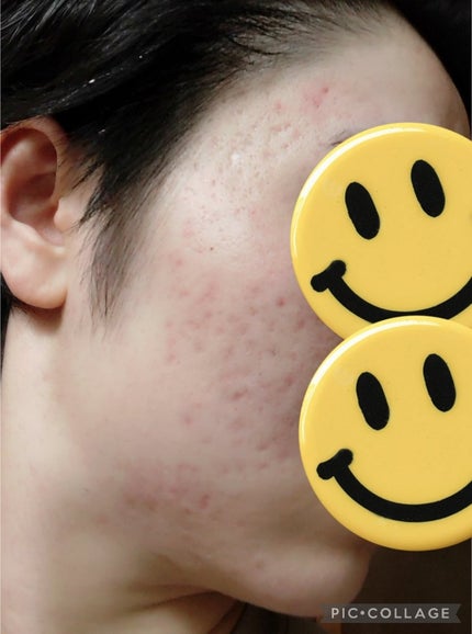 を使ったクチコミ(3枚目)