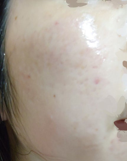 プレミアムトリートメントマスク/SUIKO HATSUCURE/シートマスク・パックを使ったクチコミ(7枚目)